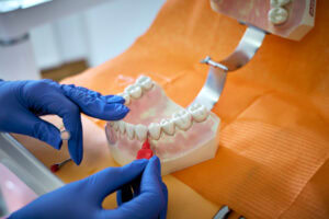 Detaillierte Zahnmodell-Anprobe für genaue Zahnrestaurationen beim Zahnarzt München.